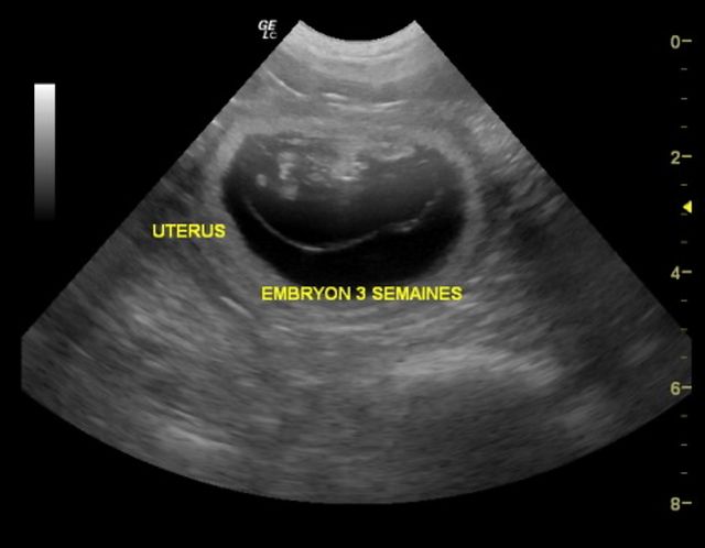 CHIOTS à NAITRE vers le 28 Décembre !!!!